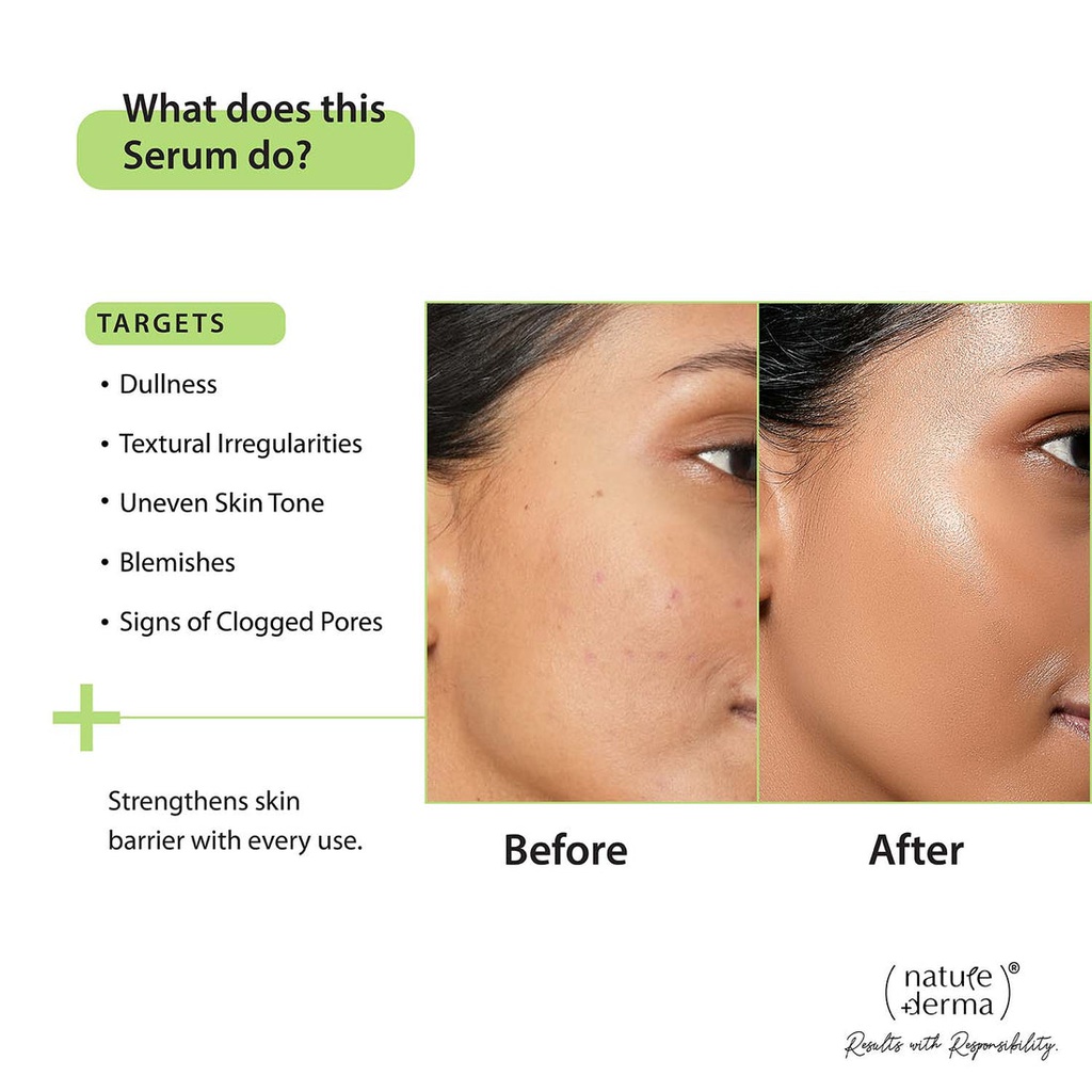 Nature Derma 10% Niacinamide And Zinc Serum - 30 Ml | Jeevee